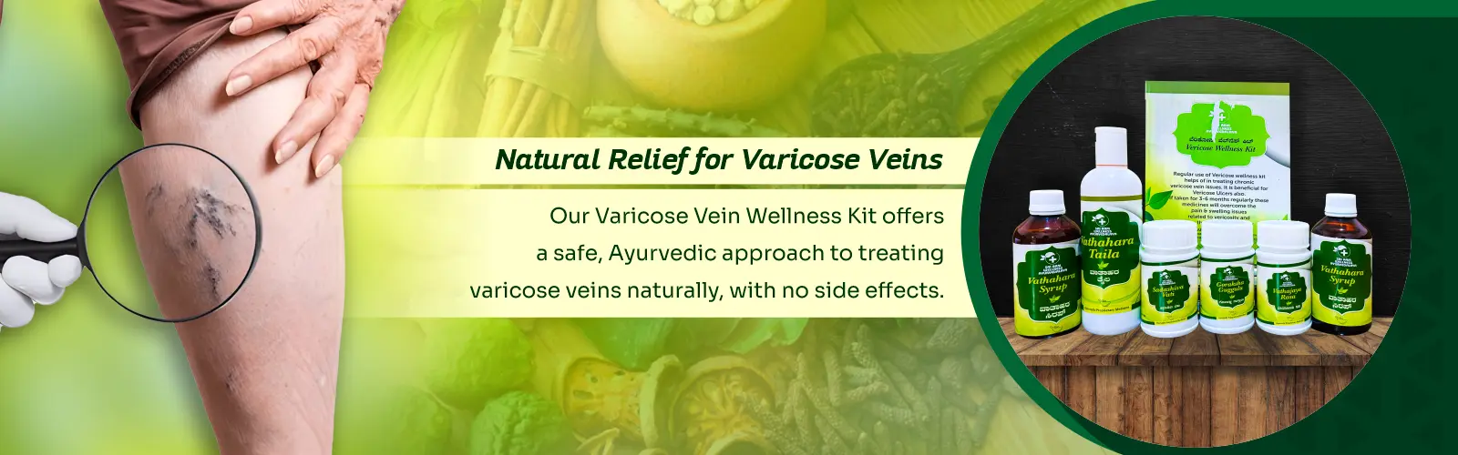 Varicose Veins 3
